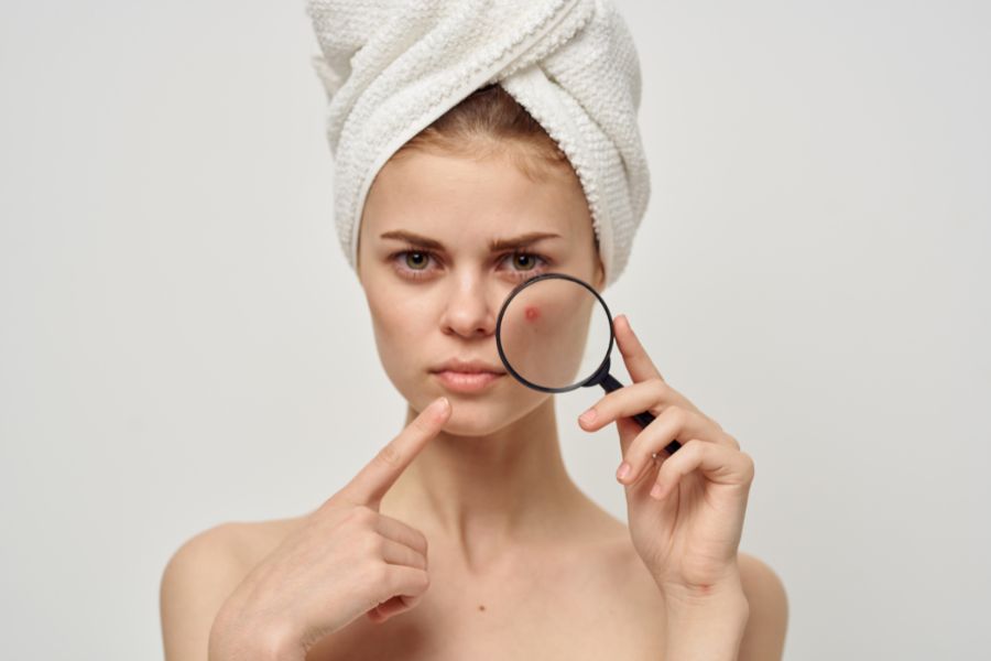 Remedies For Common Skin Conditions